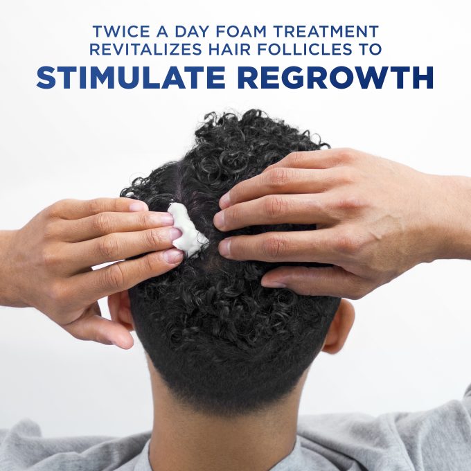 Scalp X Hair Regrowth Treatment for Men
