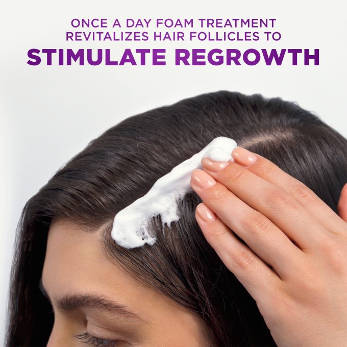 Scalp X Womens Minoxidil Treatment