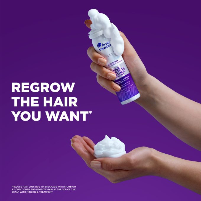 Scalp X Womens Minoxidil Treatment